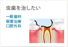 虫歯を治したい一般歯科根管治療口腔外科